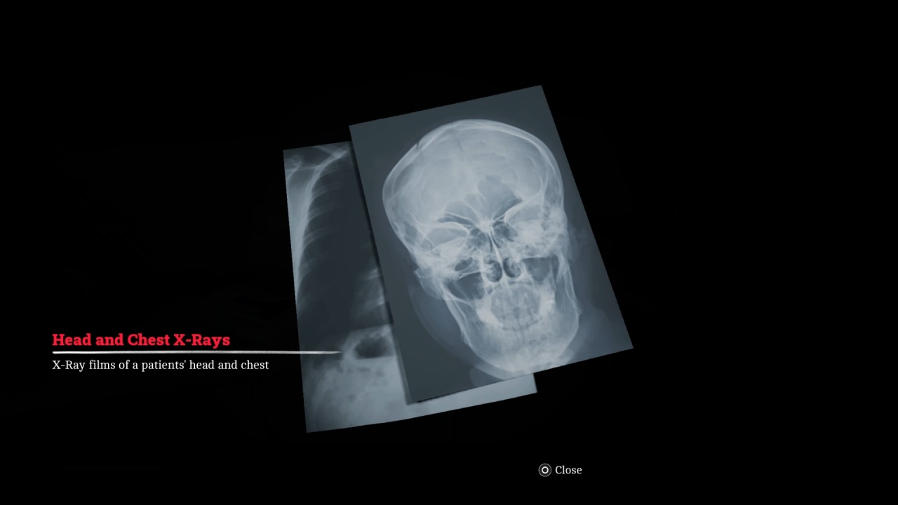 silenthill townfall head and chest xray